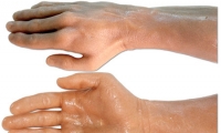 Hand and Wrist