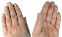 Hand and Wrist