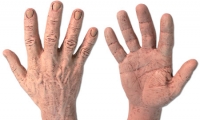 Hand