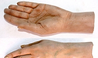 Hand and Wrist