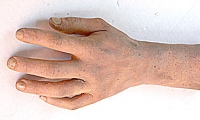 Hand and Wrist