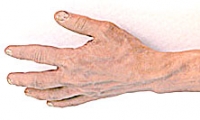 Arm and Hand