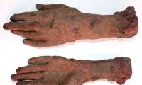 Decayed Hand and Wrist