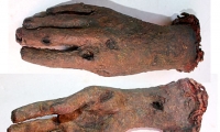 Decayed Hand
