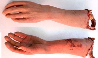 Decayed Arm and Hand