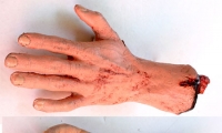 Hand and Wrist