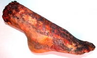 Foot and Ankle