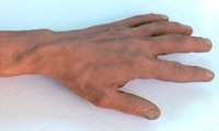 Arm and Hand