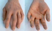 Arm and Hand