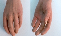 Arm and Hand