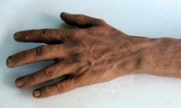 Arm and Hand
