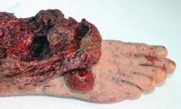 Foot