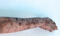 Full Arm and Hand