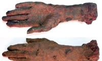 Hand and Wrist