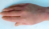 Hand and Wrist