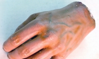 Hand