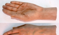Hand and Wrist