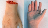 Hand and Wrist
