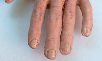 Hand and Wrist