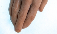 Hand and Wrist