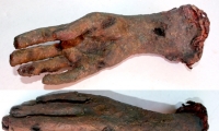 Hand and Wrist