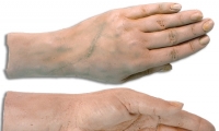 Hand and Wrist