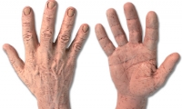 Hand and Wrist